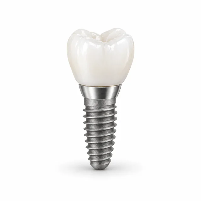 Implante dental con corona